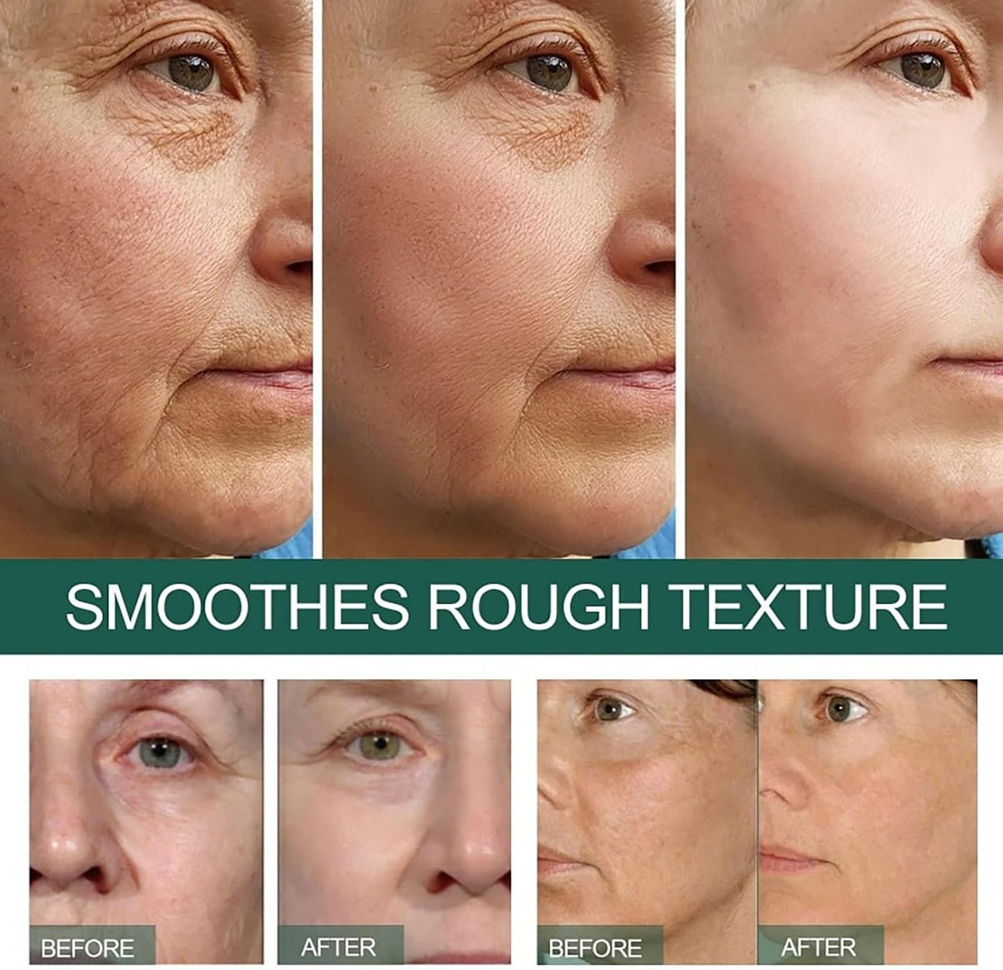 Eelhoe Dark Spot Correcting Serum