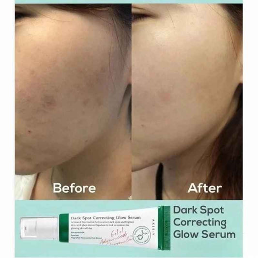 Get Radiant Skin with AXIS-Y Dark Spot Correcting Glow Serum